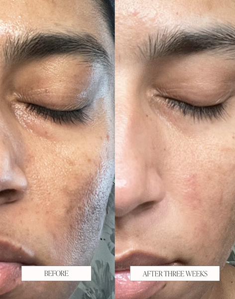 BYROE Kiwi Detox Gel Cleanser