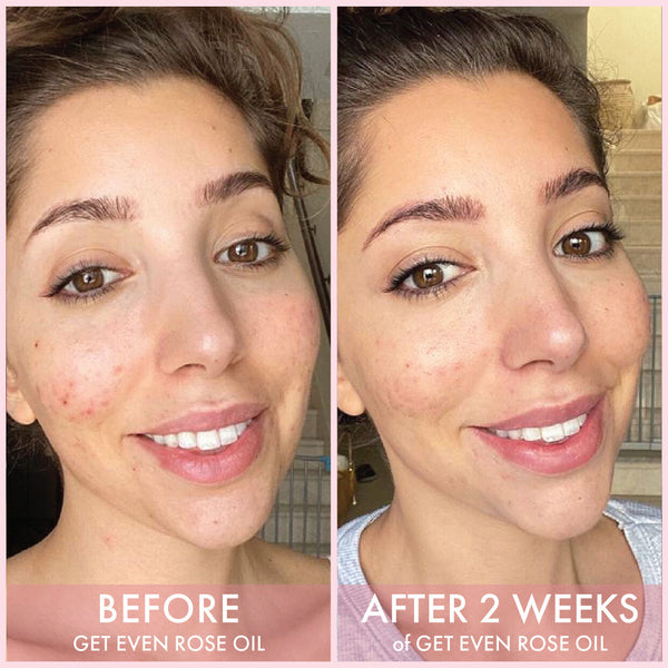 HUDA BEAUTY Wishful Get Even Rose Oil