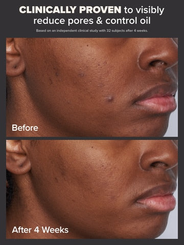PAULA’S CHOICE Skin Perfecting 2% BHA Liquid Exfoliant
