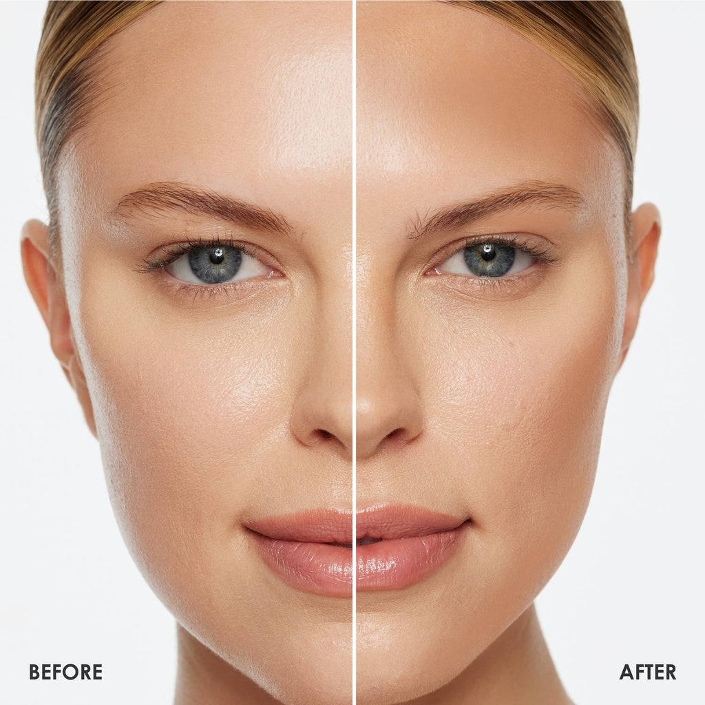 RODIAL Glass Powder