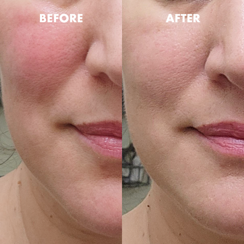 KOPARI Marine Clean Purifying Gel Cleanser