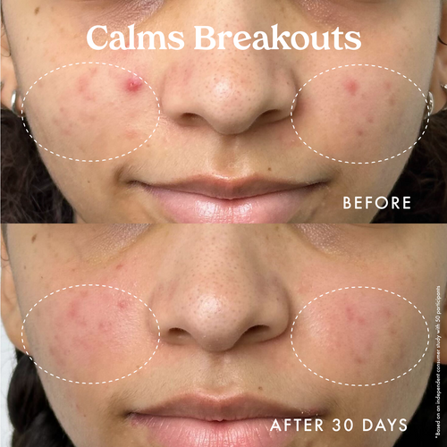 KOPARI Star Bright Vitamin C Moisturizer