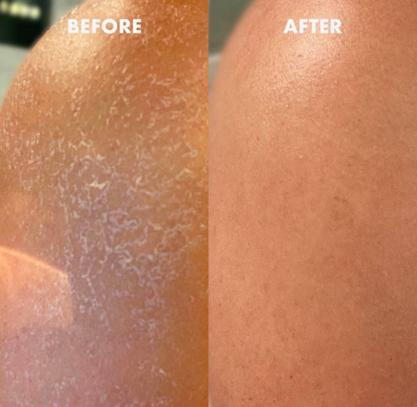 KOPARI Ultra Restore Body Butter