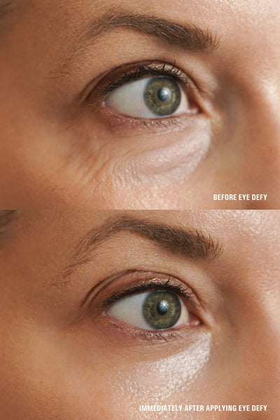 GOLDFADEN MD Eye Defy Radiance Restoring Treatment