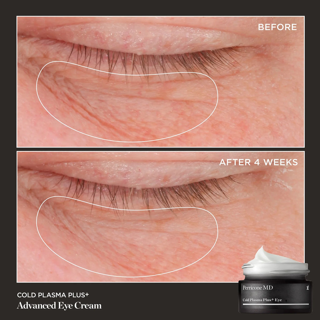 PERRICONE MD Cold Plasma Plus+ Advanced Eye Cream
