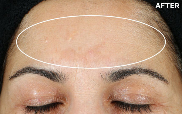 STRIVECTRIN Super-C Retinol Brighten Correct Vitamin C Serum