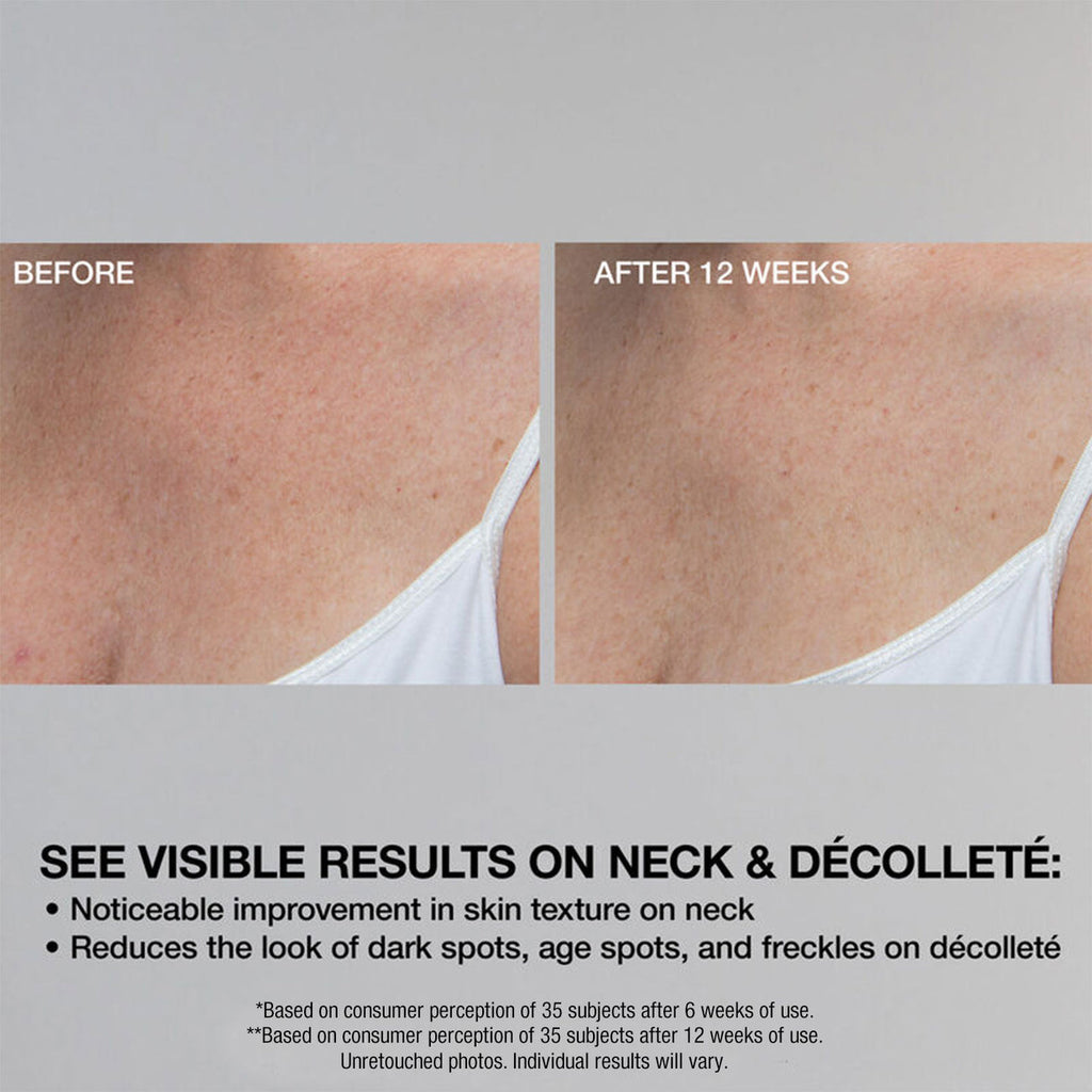 STRIVECTRIN Super-C Retinol Brighten Correct Vitamin C Serum
