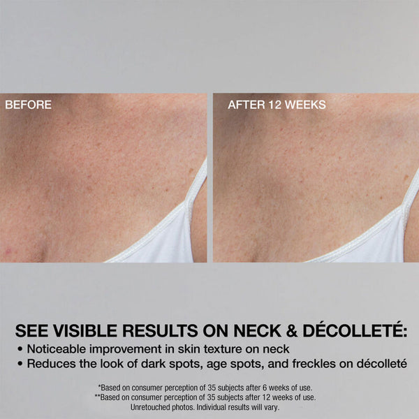 STRIVECTRIN Super-C Retinol Brighten Correct Vitamin C Serum