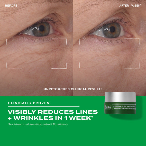 MURAD Retinal ReSculpt Eye Lift Treatment