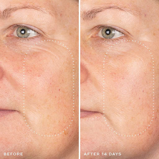 MEDIK8 Exo-Pdrm Prismatic+ Youthful Vitality Serum