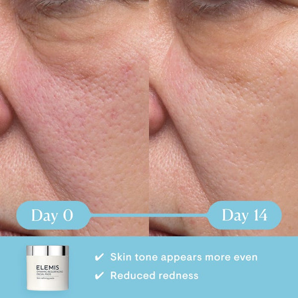 ELEMIS DYNAMIC RESURFACING FACIAL PADS