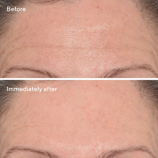 MURAD Targeted Wrinkle Corrector