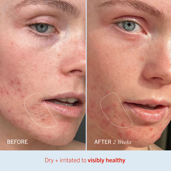 FIRST AID BEAUTY Ultra Repair Cream Intense Hydration