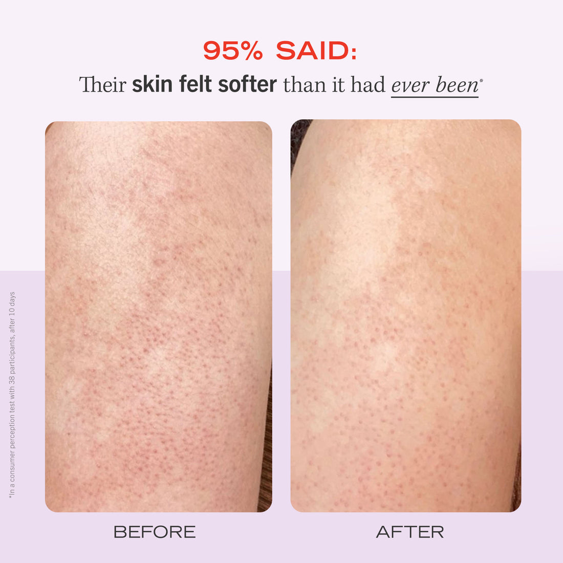 FIRST AID BEAUTY Bump Eraser Body Scrub