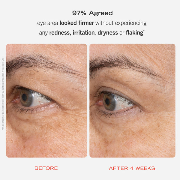 FIRST AID BEAUTY Retinol Eye Cream