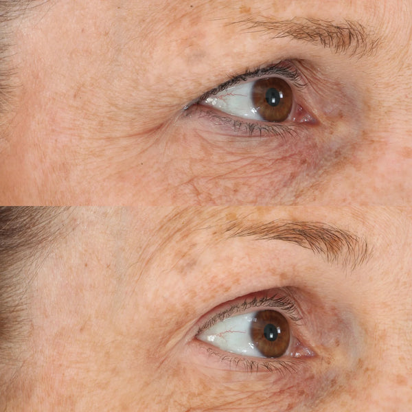 PERRICONE MD Eyelid Lift Serum