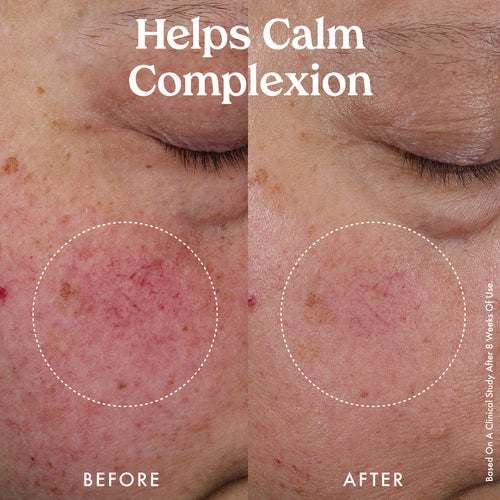 KOPARI Nourishing Hydro-Lipid Barrier Serum