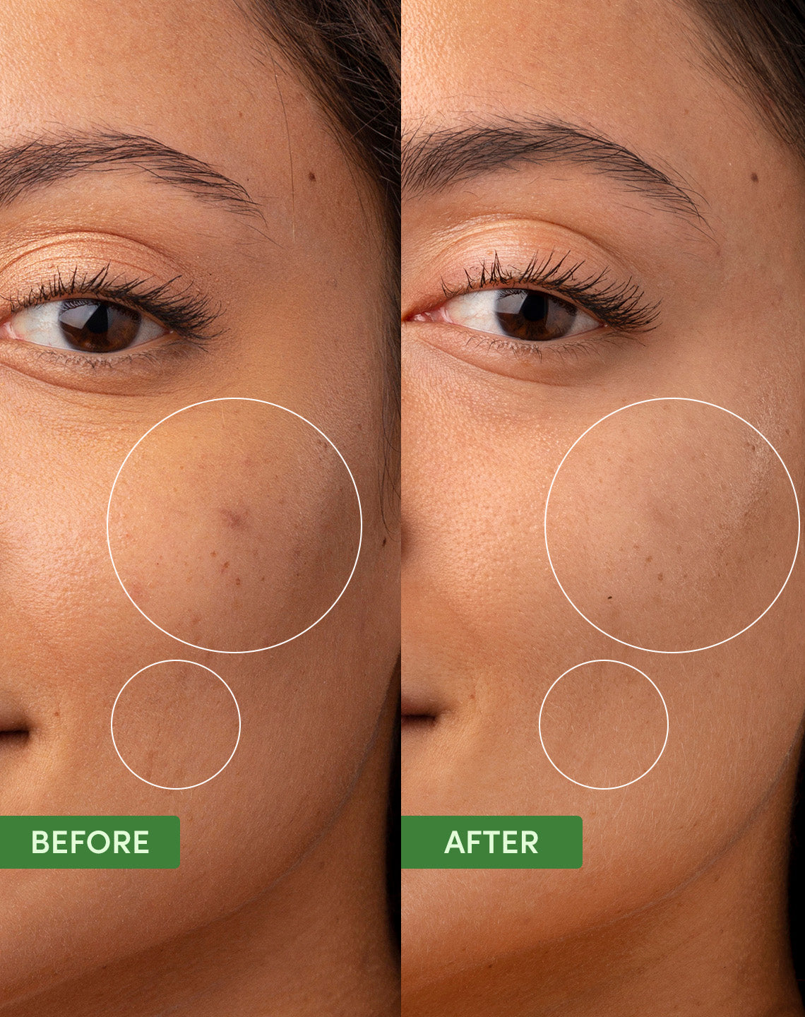 SAND & SKY Oil Control Clearing Moisturiser