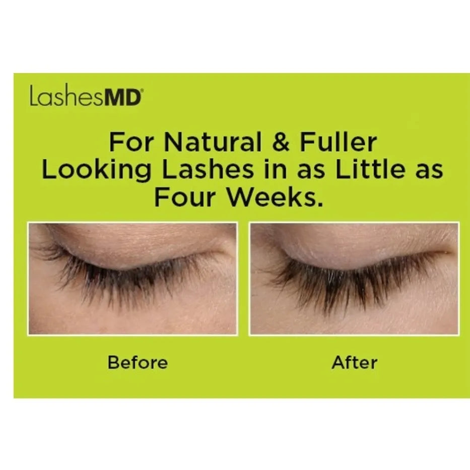 Lashesmd eyelash outlet conditioner